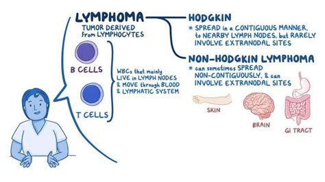 burkitt lymphoma vs hodgkin's.